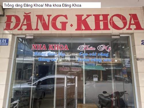 Hình ảnh Trồng răng Đăng Khoa/ Nha khoa Đăng Khoa